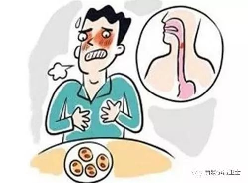 反流性胃炎如何判断？想判断反流性胃炎？这四个症状你知道了吗！