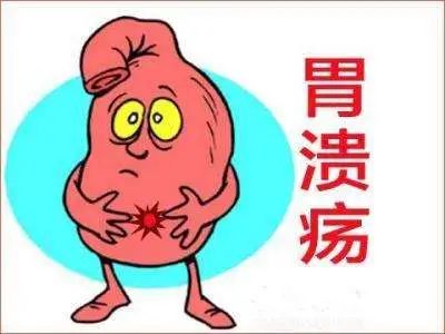 经常性胃酸反流会导致胃癌！反流性食管炎和消化道溃疡科普