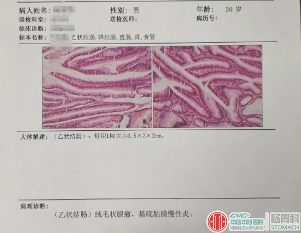 医生手记：过了四十岁一定要做次肠镜检查，关键时刻能救命！