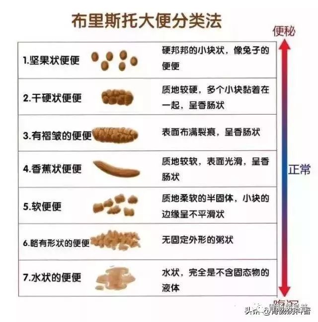 大便变细形似铅笔图片图片