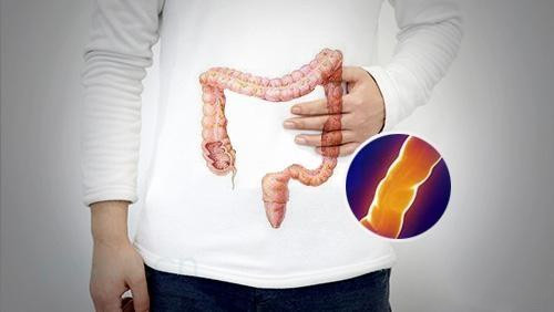 胃窦炎的保守治疗方法是什么呢?