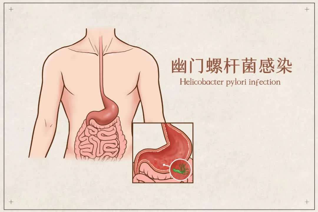 儿童患上幽门螺杆菌感染的原因是什么