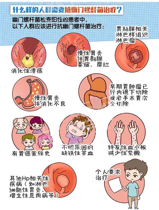 感染幽门螺杆菌一定要治疗吗？医生建议做好这3点，预防幽门螺杆菌感染！