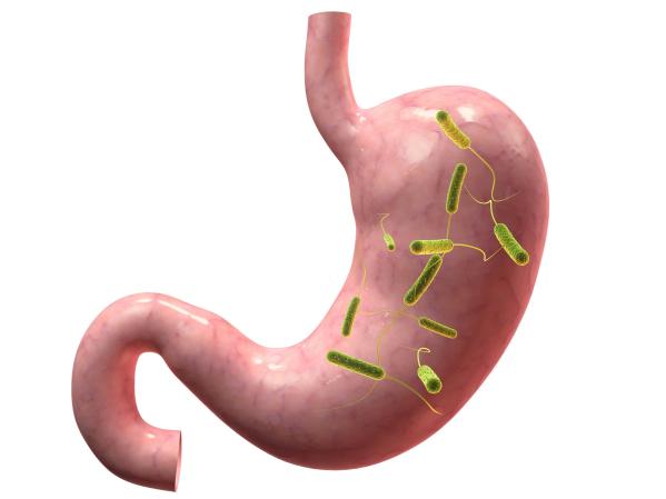胆汁反流性胃炎：胆汁为何走“回头路”