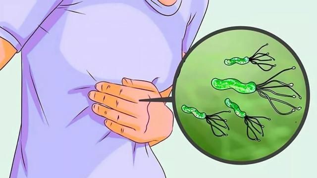 幽门螺杆菌的“对手”或被找到，平时常吃些，或有助灭菌养胃