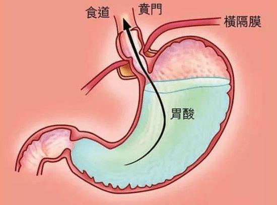 出现3种“反常”，多半胃病前兆，想养出好胃口，日常坚持做好3事