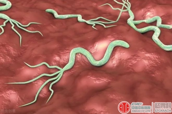 一半的中国人感染幽门螺杆菌，到底要不要治？