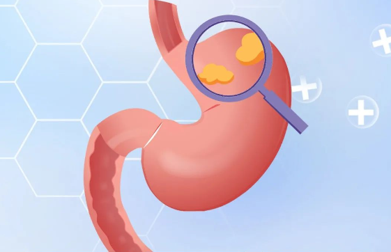 洛阳新里程医院肠胃消化科：无痛胃肠镜和无痛（精 查）胃肠镜区别