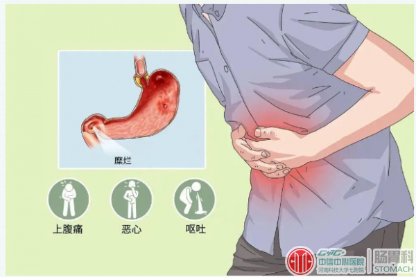 糜烂性胃炎：胃黏膜的“杀手”