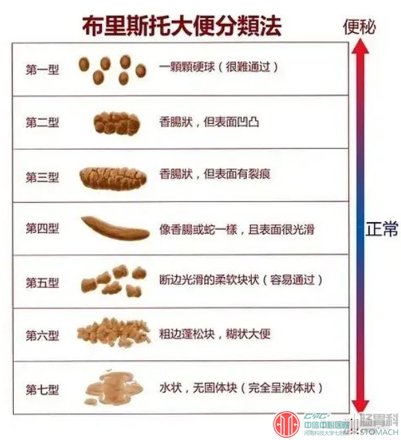 长期肚子不舒服又查不出问题，当心肠易激综合征！