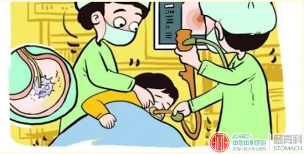告别肠胃不适，肠胃镜检查攻略