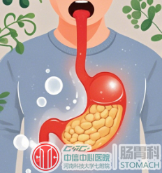 胆汁反流性胃炎：胃里的“不速之客”